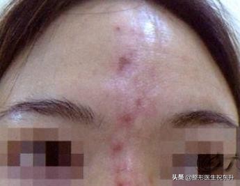 不明注射物有什么后遗症,远离不明注射物