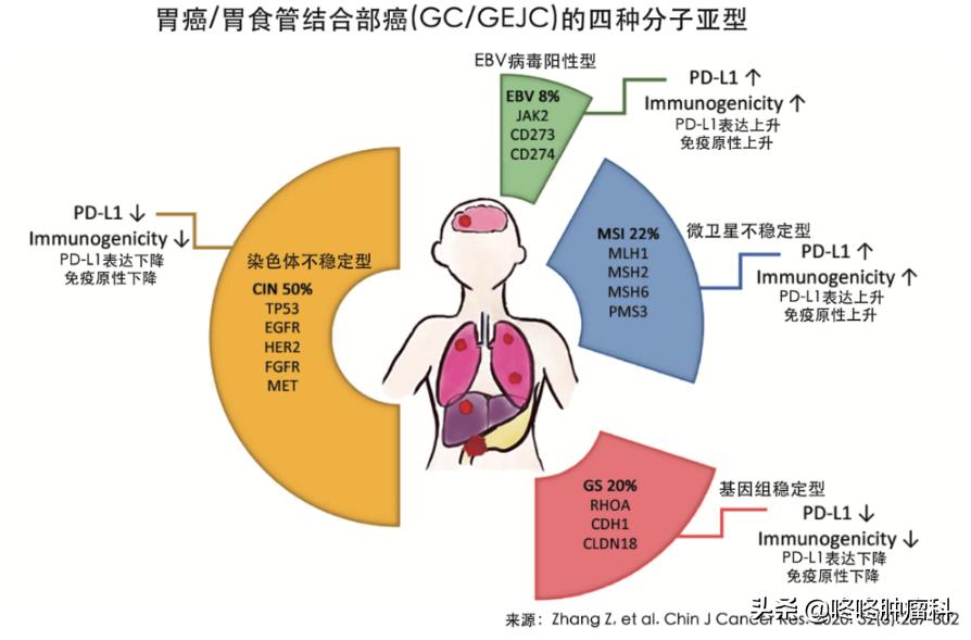 胃癌pd-l1检测多少钱,胃癌使用pd-1免疫治疗有效图片