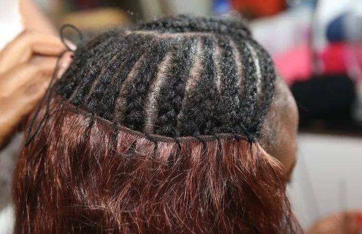 一位秃顶者的自白:我只想看上去和大家一样,然后混迹人群