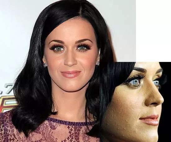 女生闭口痘痘怎么处理好得快,女生脸上有闭口痘痘怎么解决