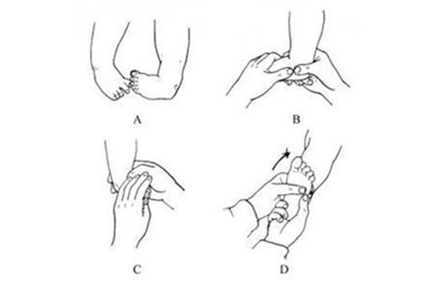 影响孩子脚发育的鞋,什么样的鞋对宝宝足底发育好