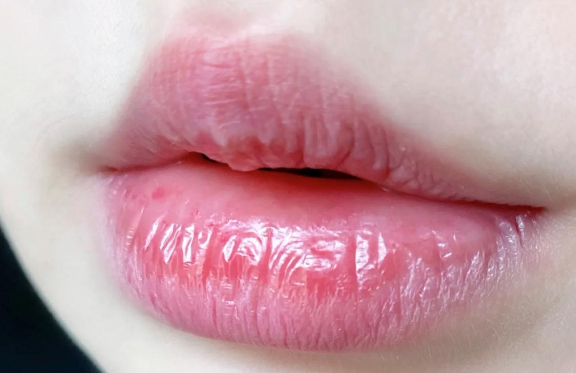 嘴唇变丑的十大坏习惯,这几个习惯会使嘴唇变得越来越厚
