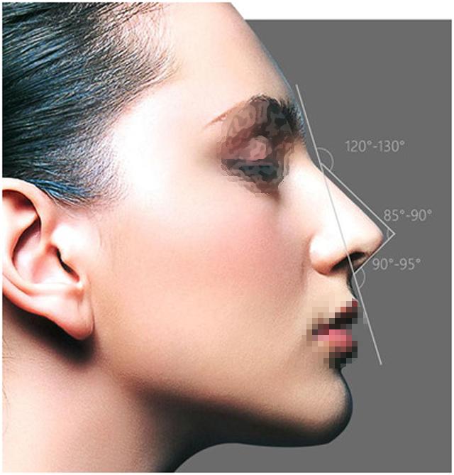 玻尿酸隆鼻鼻子变宽怎么办,玻尿酸隆鼻变宽了还能隆鼻吗