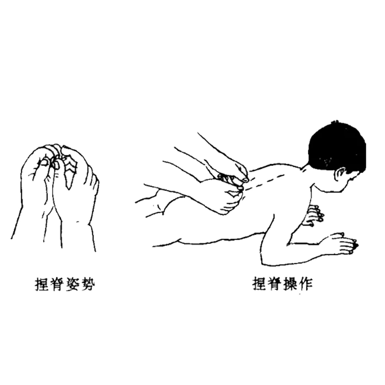 宝宝一运动就出汗用什么止汗,宝宝一动就出汗大汗淋漓怎么解决