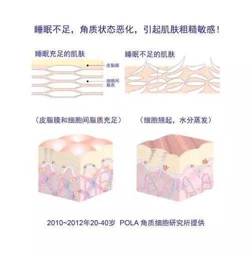 角质层薄容易过敏,角质层薄适合的水