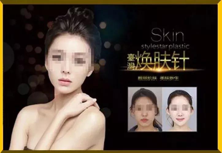 花了26万做整容手术,24岁女子花21万整容