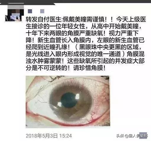 美瞳毁了一个女孩是真的吗,正在被美瞳毁掉的女孩们