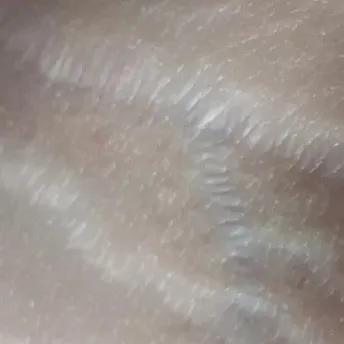 又到了穿小裙的季节，鸡皮女孩该怎么办……