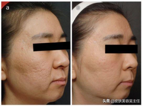 平常人能好看到什么程度,人能漂亮到几岁