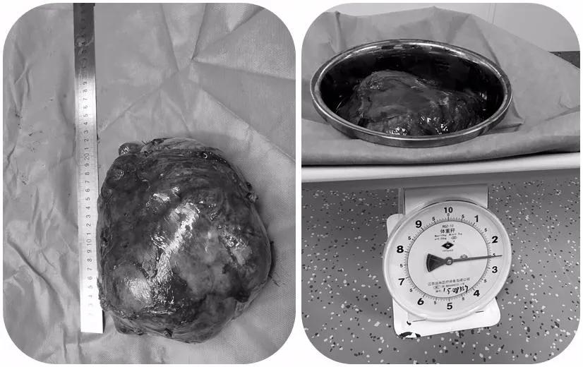 男子高烧39度,一男子高烧39.8度