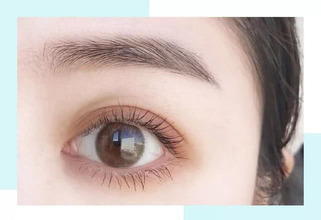 各种双眼皮类型,四种公认最丑双眼皮