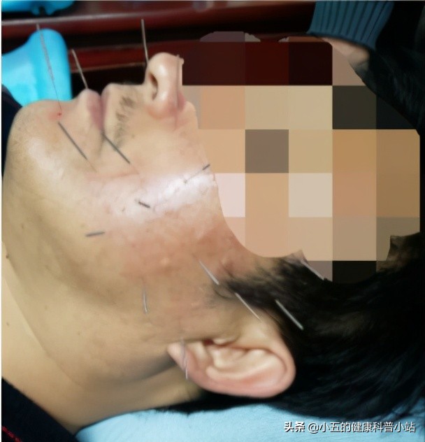 浜ㄧ壒缁煎悎寰佺殑鐗圭偣,浜ㄧ壒缁煎悎寰佺殑鐗瑰緛