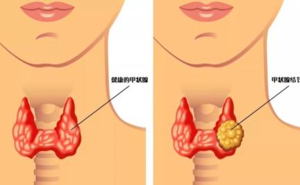 贵阳女子榨干闺蜜几十万被抓后称:我好心疼你