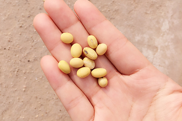 女性长胡子是什么原因引起的,去除唇毛会长胡须吗