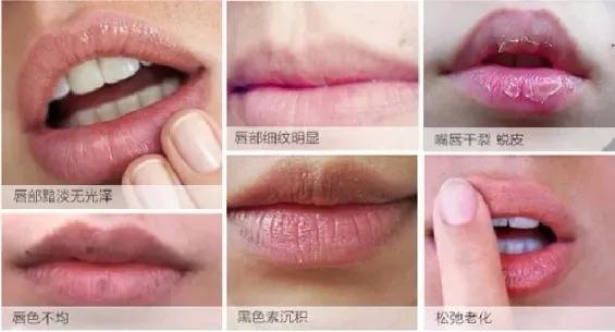 5秒恢复嘴唇水润,告别唇部暗沉、细纹