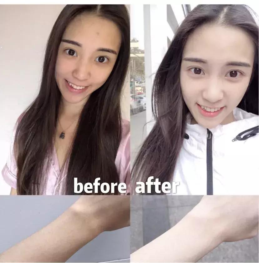 日本这个赛过美白针的王牌内服，让贵妇POLA、SK-II靠边站！