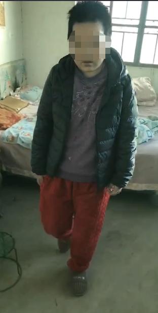 脑室有粘连脑积水有什么办法,脑动脉畸形手术后出现急性脑积水