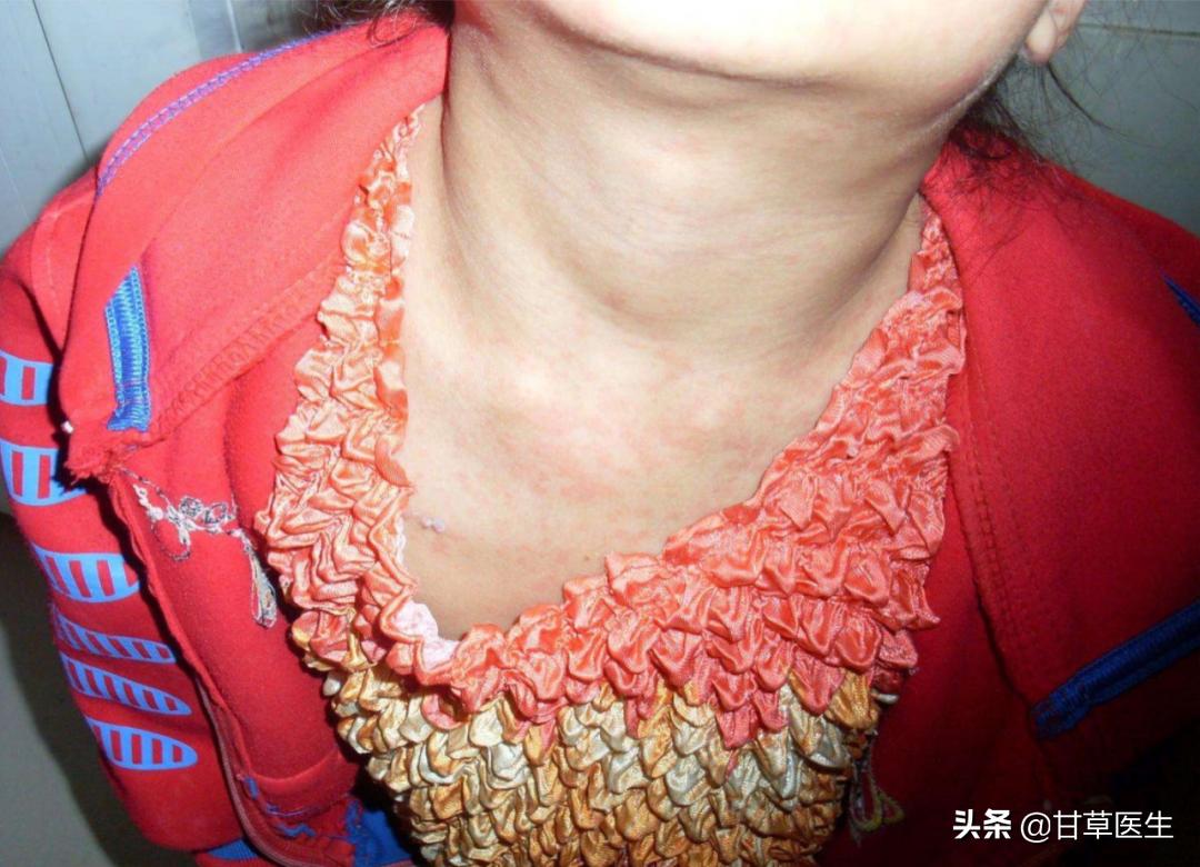 发现硬块是什么原因,发现包块是癌症晚期吗