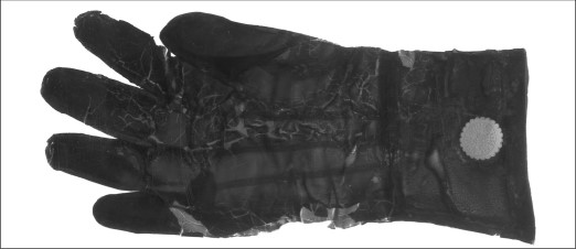 戴医用手术手套,戴医用手套视频