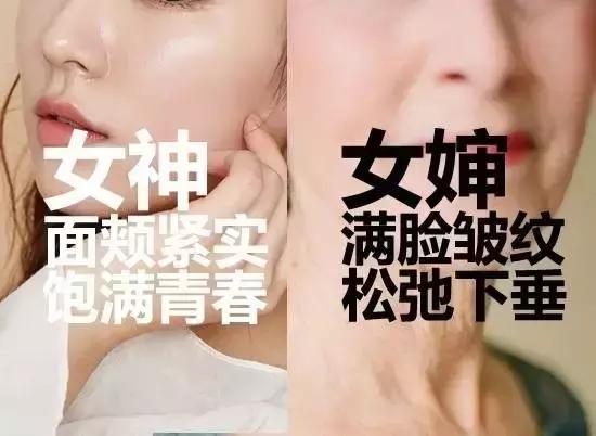 王祖贤到底有没有整容,王祖贤整容成功了吗
