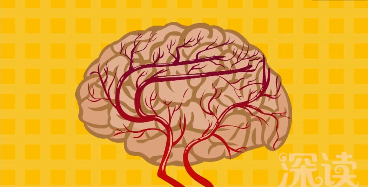 脑血管堵住了怎么办,脑血管堵了怎么办最好的方法