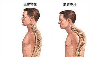 大人小孩含胸驼背怎么办?运动训练师教你一套简单易学动作