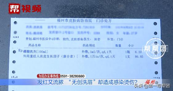 无创洗眉真的不会留疤吗,无创洗眉最后绝对不留疤痕吗