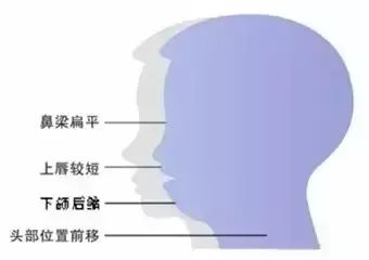 三岁孩子矫正牙齿后又反复,孩子牙齿矫正一个月看不到效果