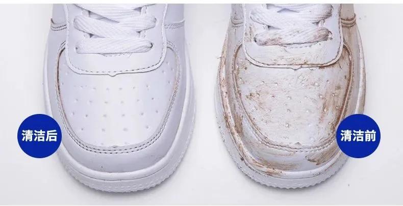 小白鞋去污摆脱暗黄,小黑鞋怎么清洗才干净
