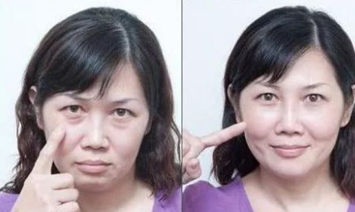 使用眼霜99%的人都犯过这些错,用几百块的眼霜竟然会长脂肪粒