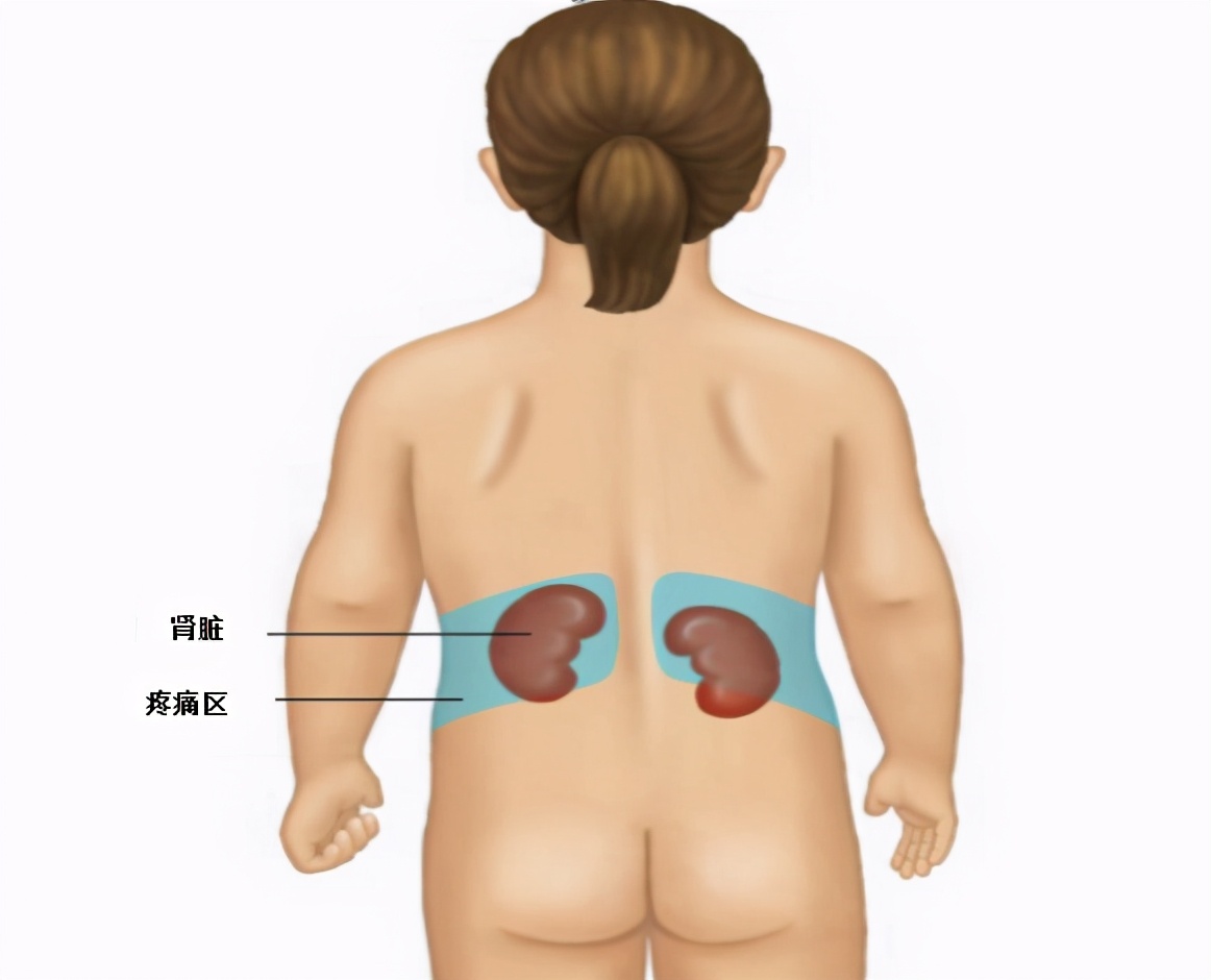 什么情况会导致儿童尿路感染,小孩尿路感染症状及治疗方法