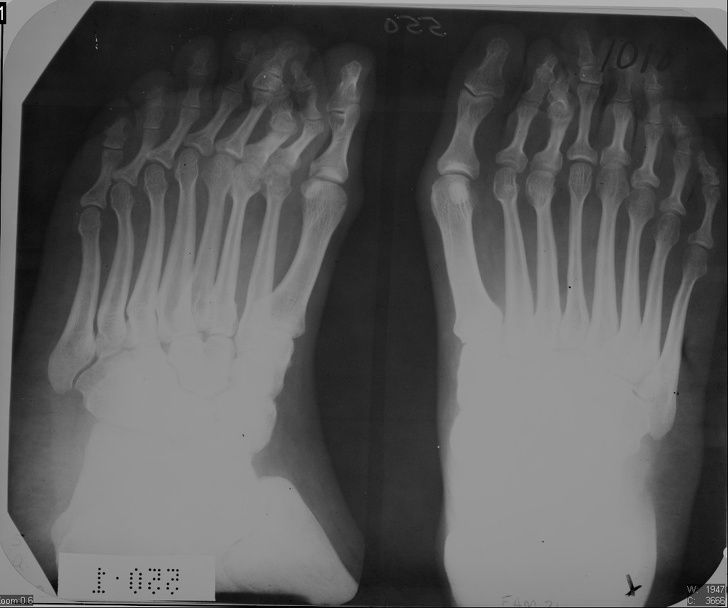 x射线下的人体图,x射线照片