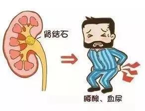 血尿意味着什么病,血尿儿茶酚胺正常意味着什么