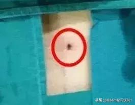 榆林佳县治疗腰椎间盘突出,榆林腰椎间盘突出最有效治疗