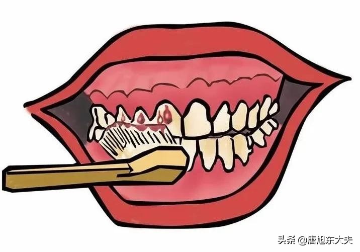 反复出现出血点检查一切正常,突然出血做什么检查