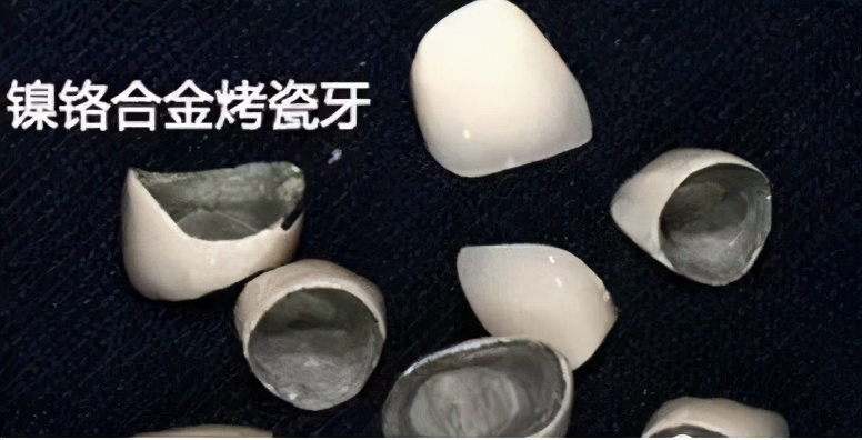 上海雅悦齿科种植牙,雅悦齿科种植牙