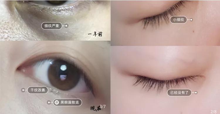 为什么用眼霜反而细纹多了,眼霜用了到底有没有效果