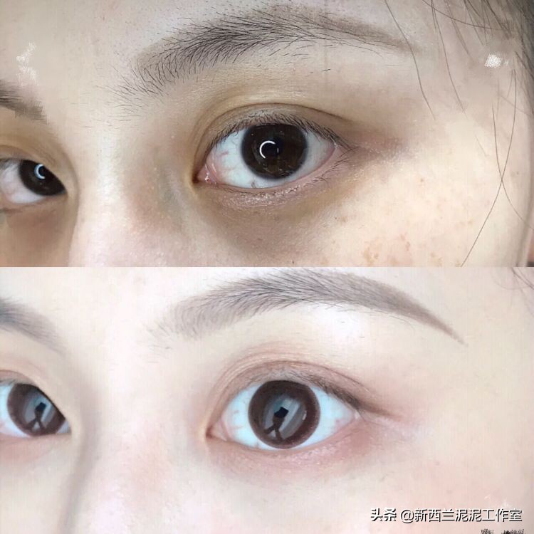 吴昕同款祛黄脸,吴昕眼袋