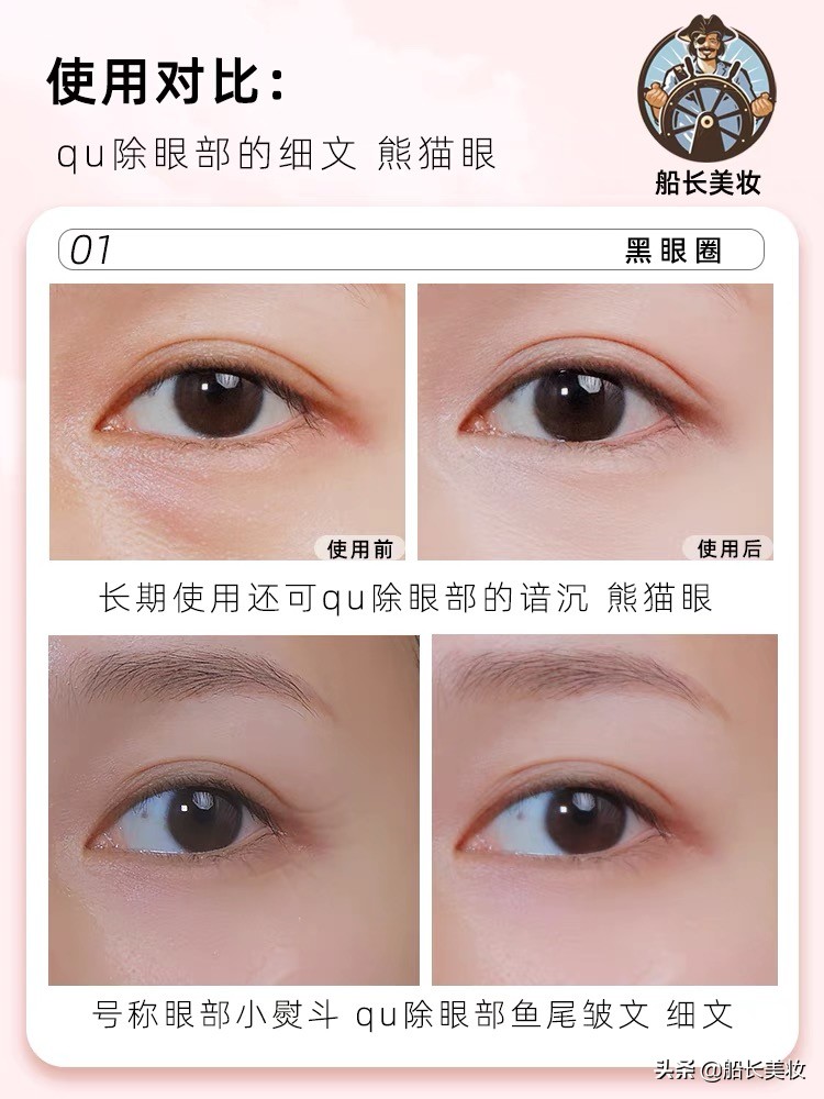 去皱黑眼圈眼膜推荐,蛇毒眼膜去黑眼圈眼袋效果怎么样