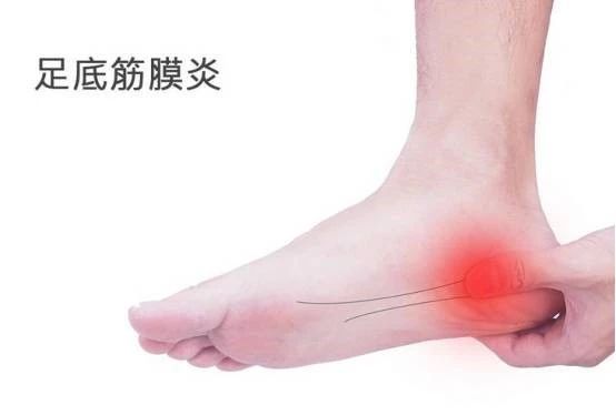 体能康复|跳绳中容易出现哪些问题呢？