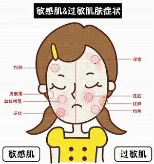 甲醛超标身体初期反应,甲醛超标怎么检测