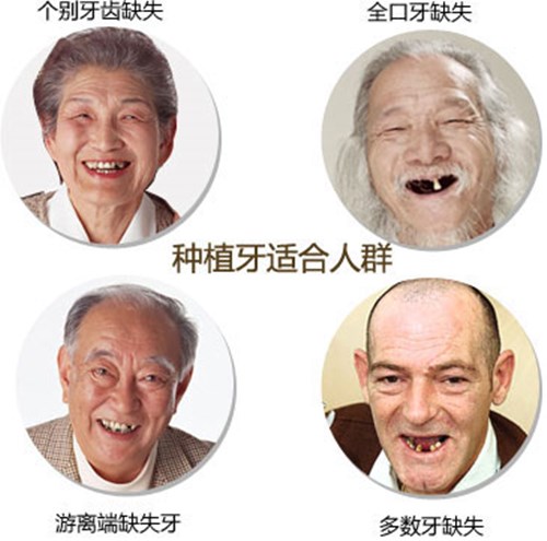 北大口腔医院种植科微创种牙,大连齿医生口腔可靠吗