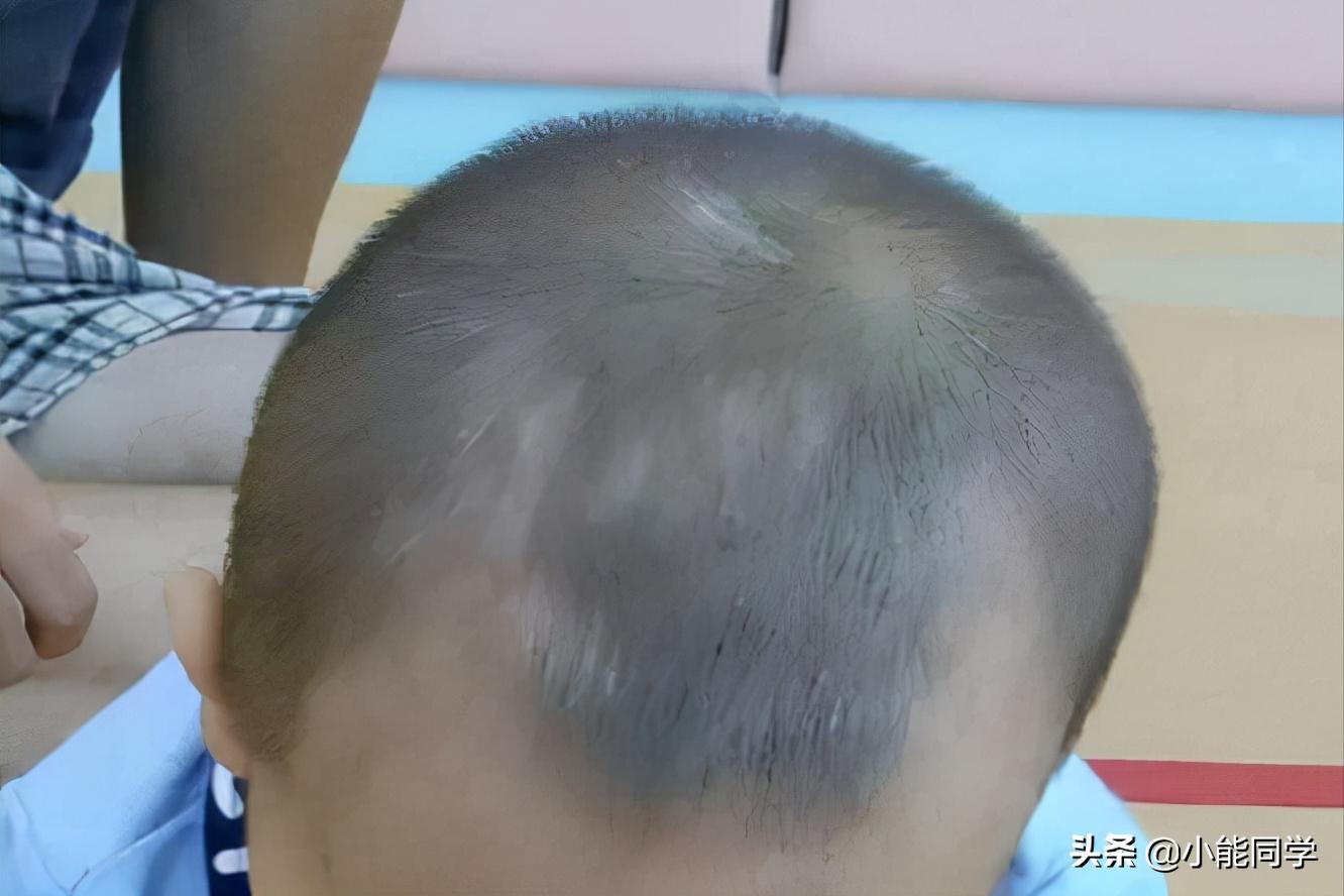 四岁孩子头发双黄是营养不良吗,宝宝头发稀黄可能并不是营养不良