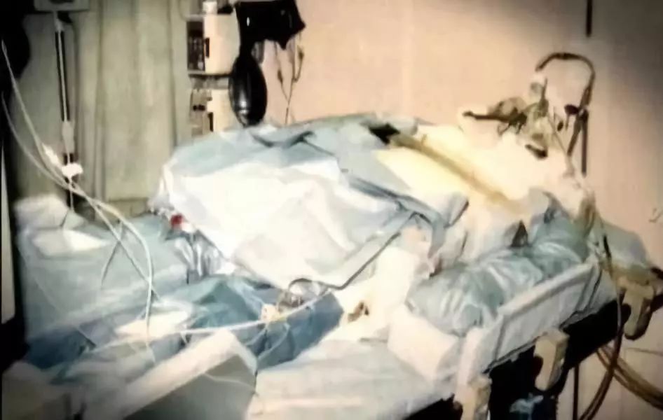 83天核事故救治纪录片,核灾83天死亡全记录