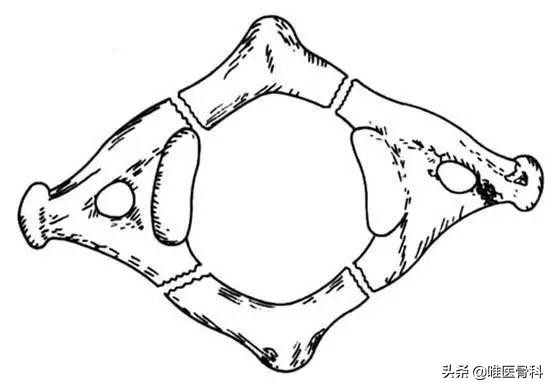 儿子脖子突然不敢往一面歪,孩子突然肩膀一高一低脖子歪