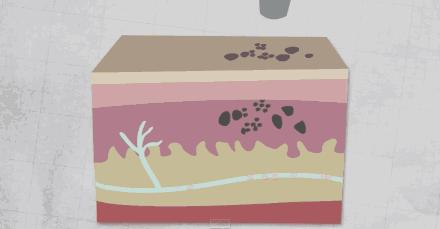 关于激光美容的几个误区你知道吗,走出激光美容的10个误区