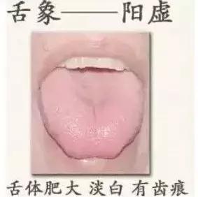 观舌识病22种舌诊图解大全,舌诊看舌头视频