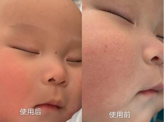 国产新品抗皱面霜,强生和启初面霜哪个好