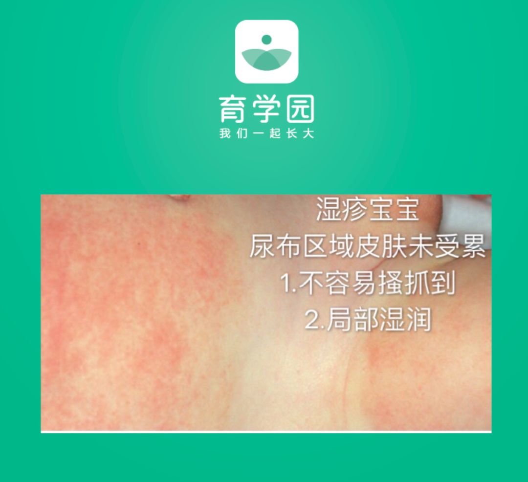 崔玉涛宝宝可以用的激素,崔玉涛谈小安素激素