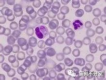 狗狗得了犬瘟怎么办？带你全面了解犬瘟病毒，铲屎官必看